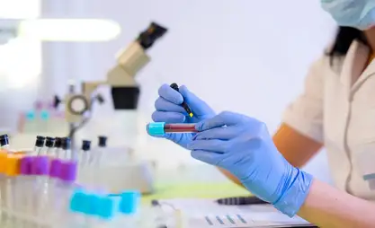 Zorunlu Sağlık Sigorta Fonu, vatandaşlara ücretsiz laboratuvar testlerine erişim haklarını hatırlattı